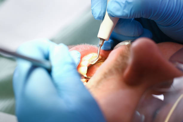 Best Urgent Dental Care for Toothache in Stamford, TX