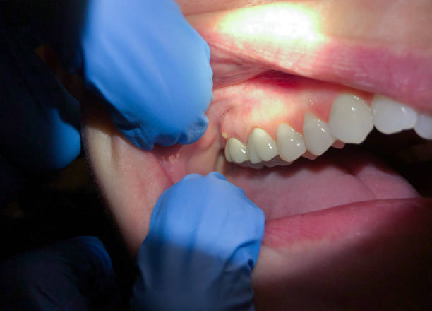 Best 24-Hour Emergency Dentist in Stamford, TX